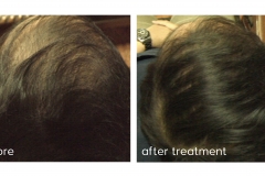 before after 1