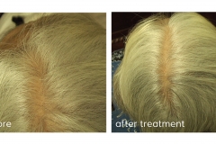 before after 2