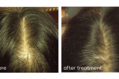 before after 3
